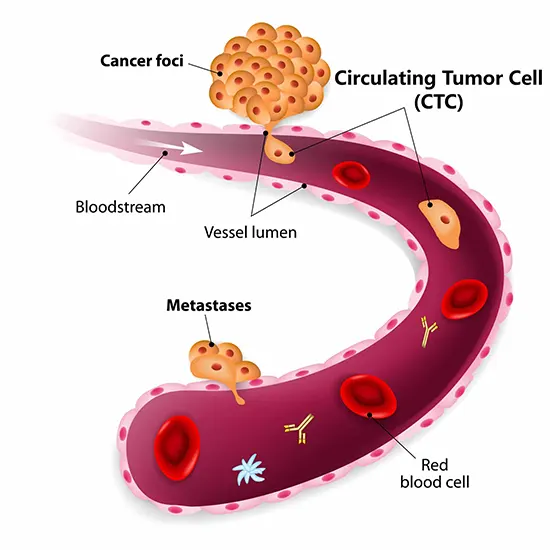 Circulating Tumor Cell (CTC)